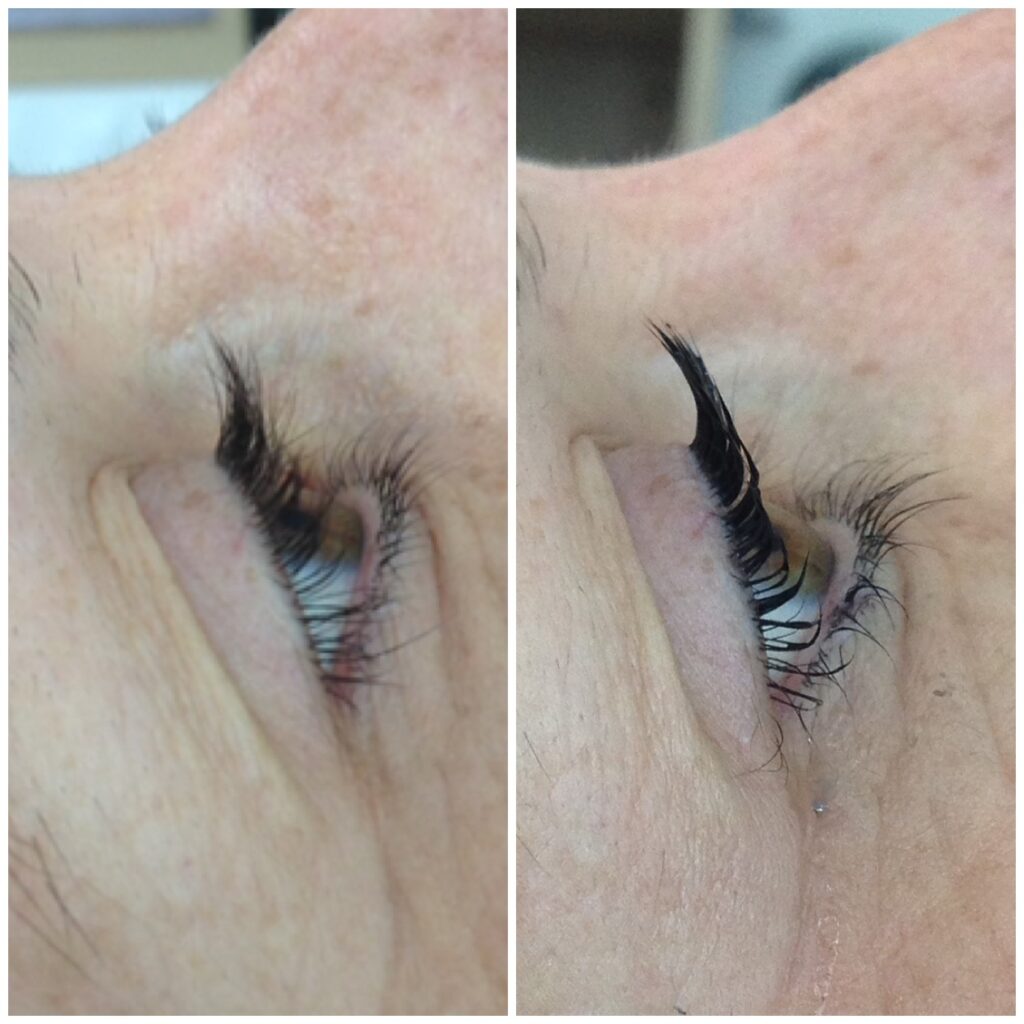 Wimpernlifting